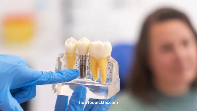 How To Fix A Loose Tooth Implant (2) How To Fix A Loose Tooth Implant (2)