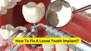 How To Fix A Loose Tooth Implant (2)