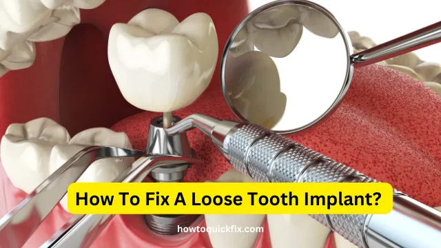 How To Fix A Loose Tooth Implant (2)