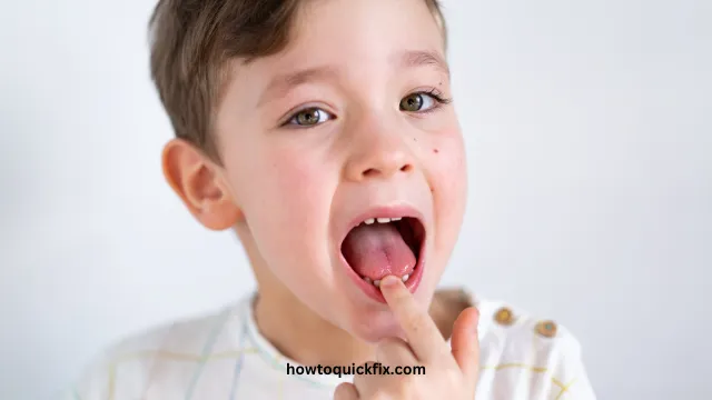 How To Tighten A Loose Tooth Naturally (2) How To Tighten A Loose Tooth Naturally